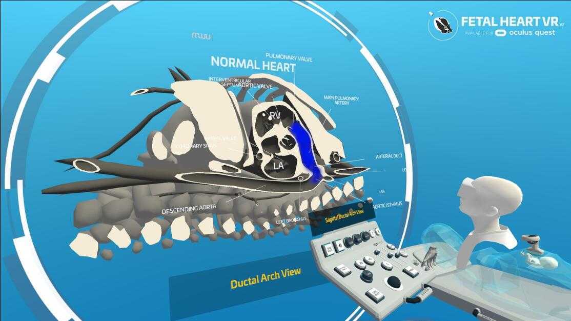 心脏病医学VR（Fetal Heart VR）- Oculus Quest游戏